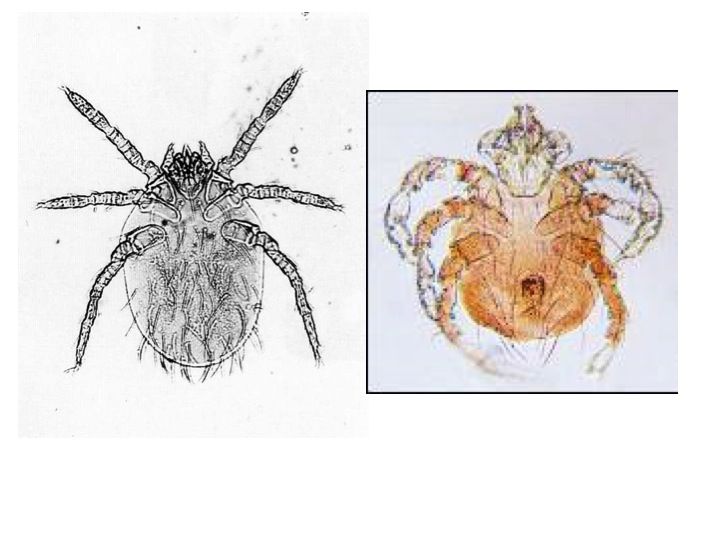 Ấu trùng mò Leptotrombidium dưới kính hiển vi