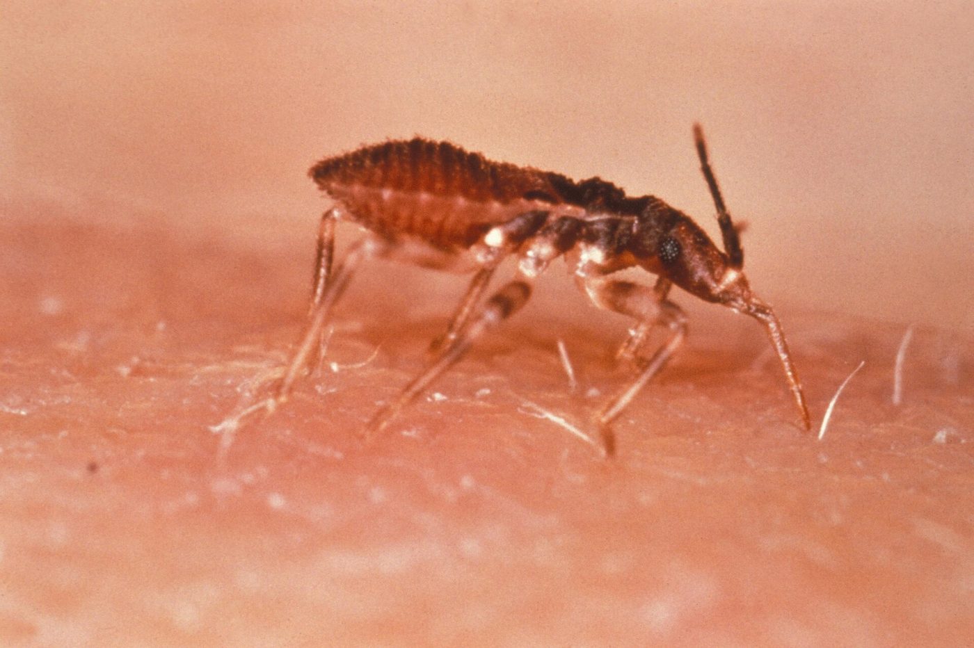 Bọ xít hút máu Triatoma infestans trên da người