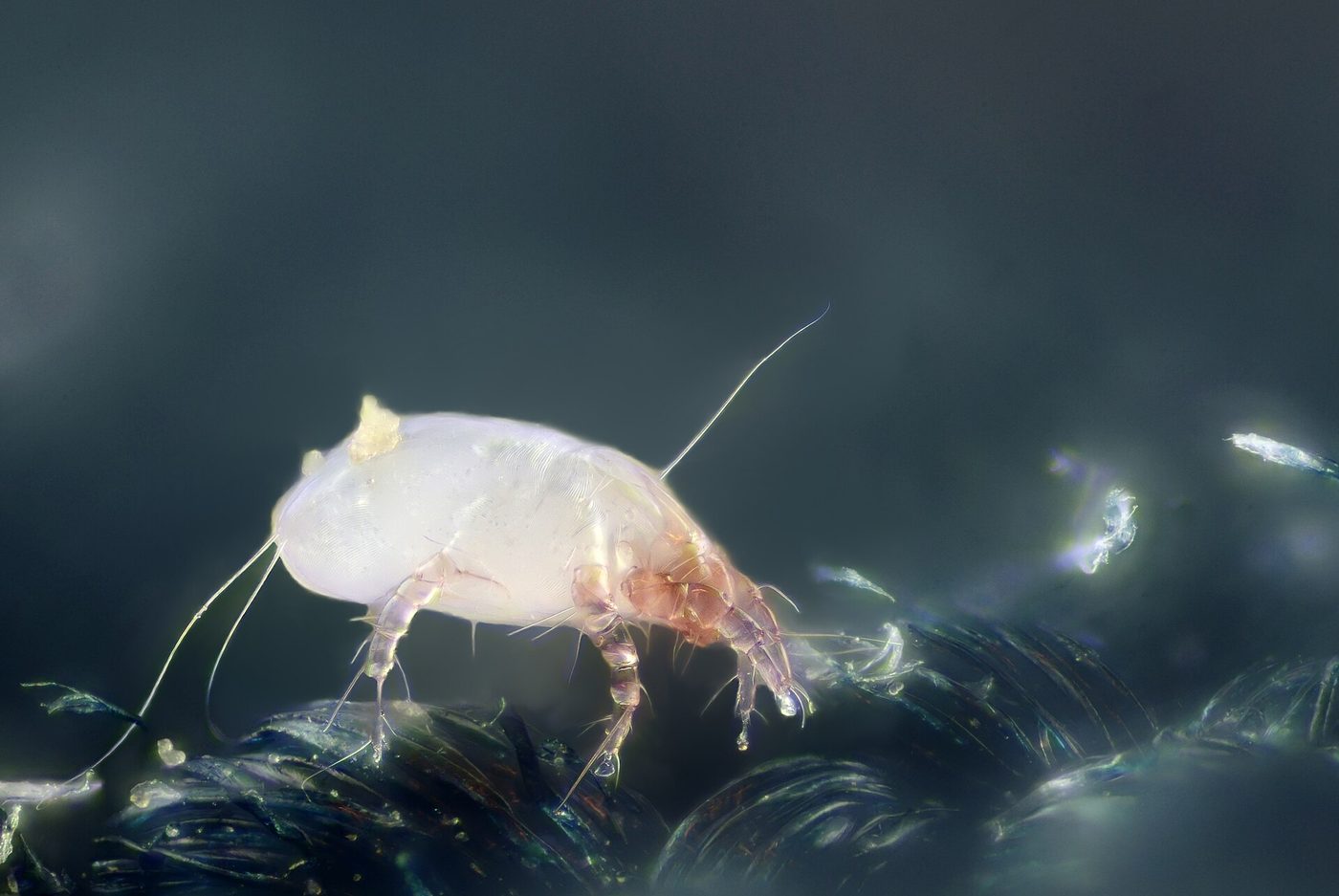 Mạt bụi nhà (Dermatophagoides pteronyssinus) chụp phóng đại