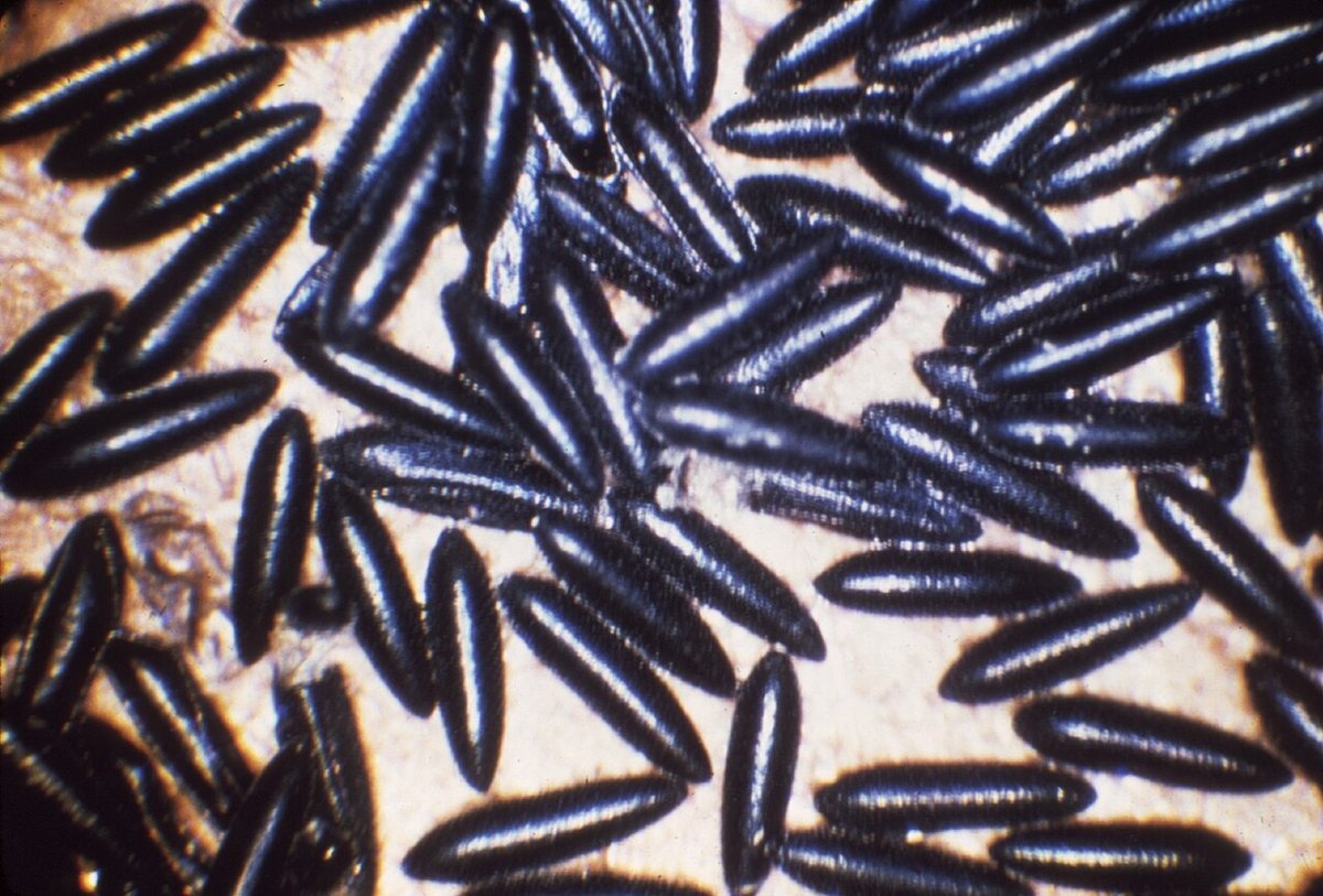 Trứng muỗi Aedes aegypti bám thành dụng cụ chứa nước