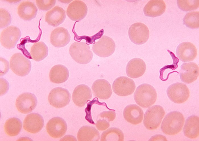 Trùng roi Trypanosoma trong phết máu bệnh nhân bệnh ngủ châu Phi (CDC PHIL 613)