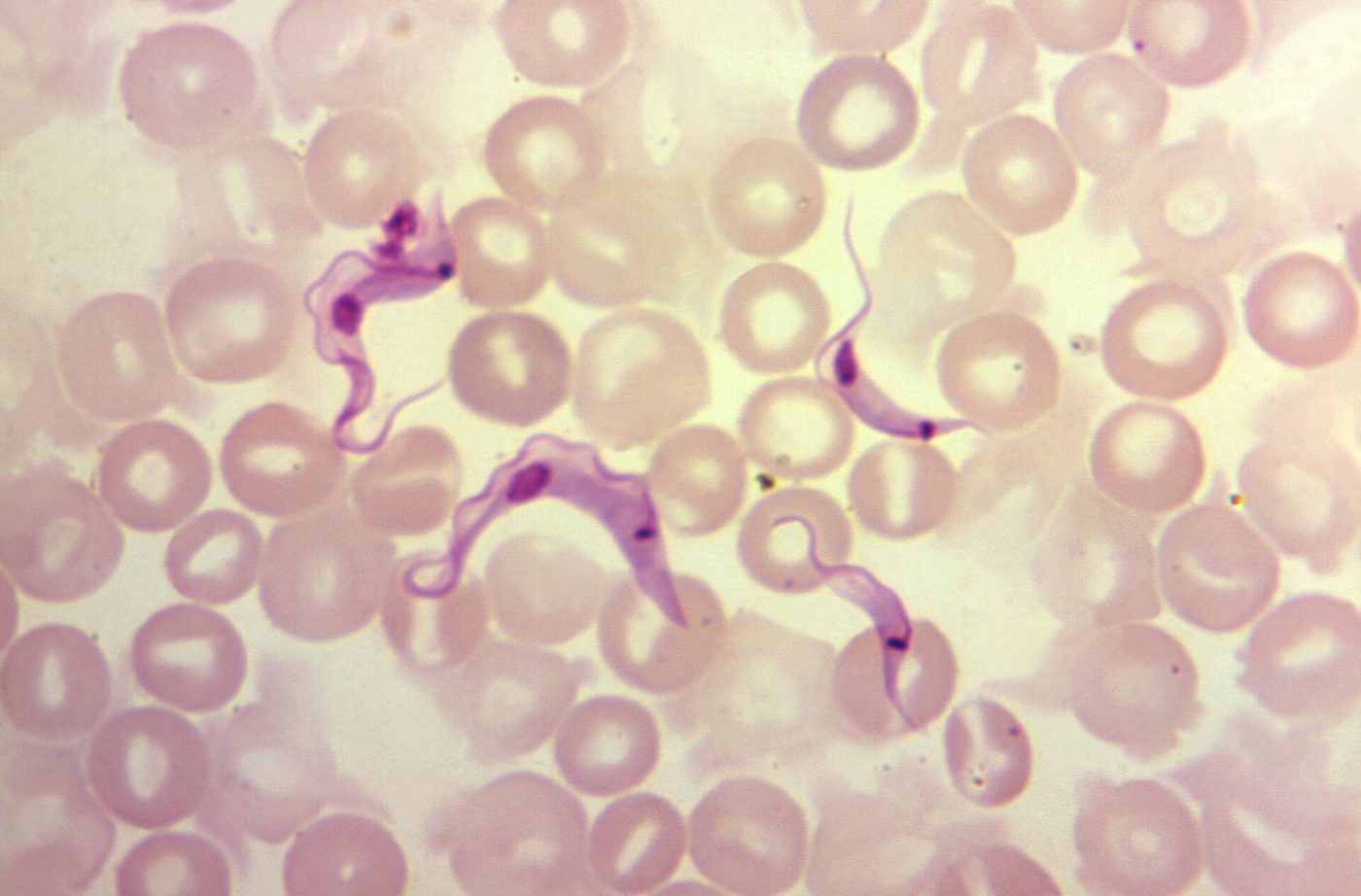 Ký sinh trùng Trypanosoma cruzi dạng có roi (trypomastigote) trong phết máu, phóng đại 1200 lần (CDC)