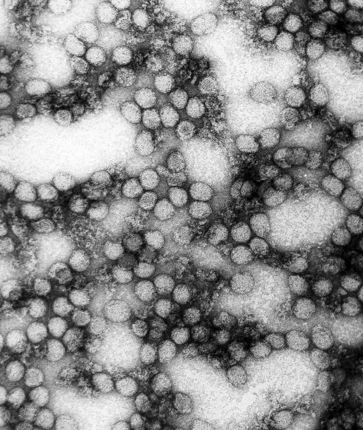 Ảnh hiển vi điện tử truyền qua các hạt virus sốt vàng (CDC PHIL 8239)
