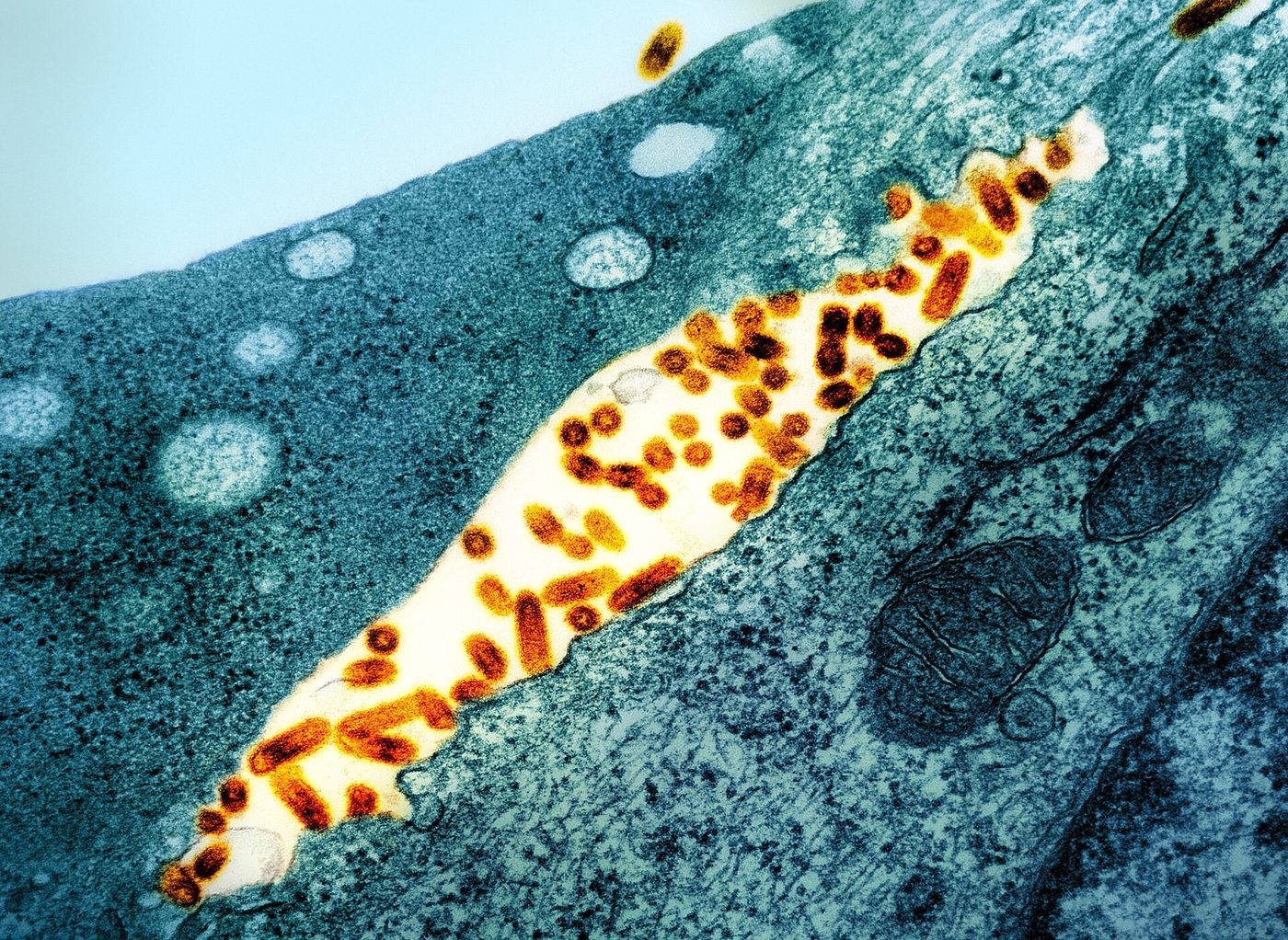 Ảnh hiển vi điện tử truyền qua (tô màu): hạt virus viêm miệng mụn nước VSV (màu cam) nảy chồi từ màng tế bào nhiễm